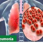 Pneumonia - latesthealthfacts